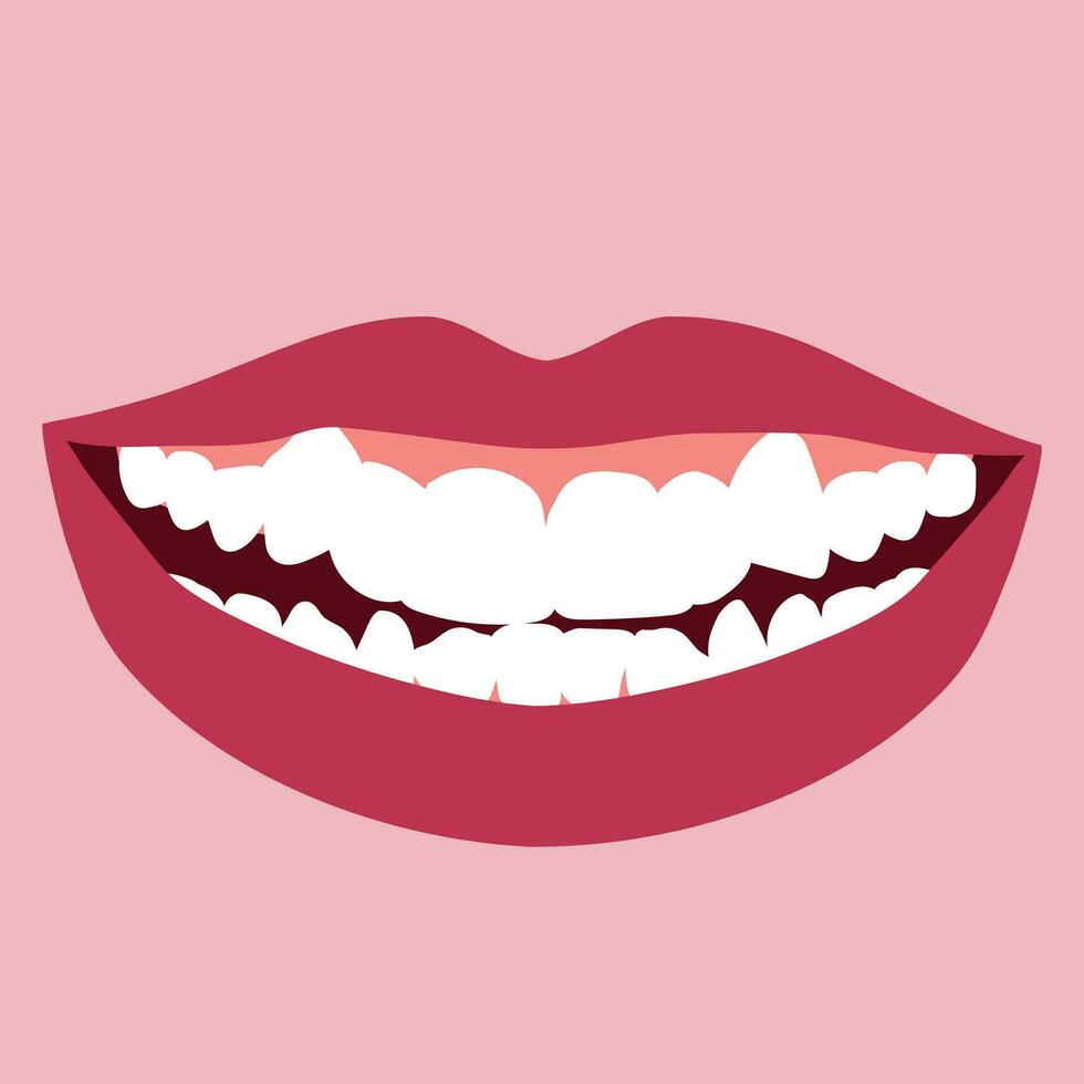 leende med ortodontisk problem tänder trängsel. dubbel- tand. onormal utbrott. motsatt ocklusion, öppen bita, fullt med folk tänder, hålrum, dentition. vektor illustration