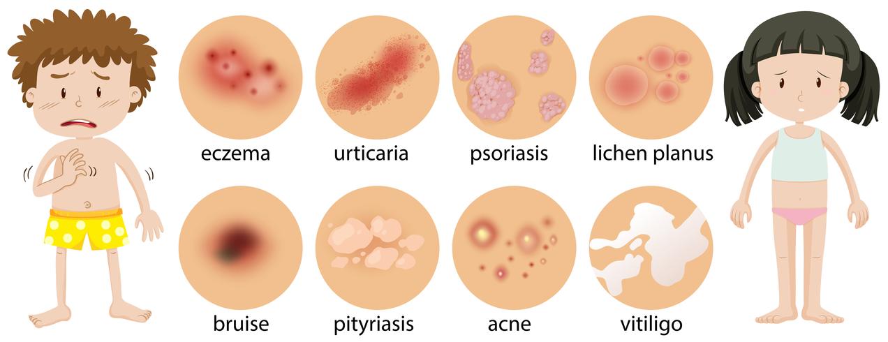 Kleinkinder mit unterschiedlichen Hauterkrankungen vektor