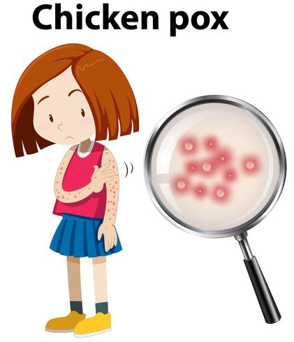 Ung tjej med kycklingpox vektor
