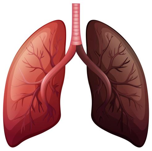 Lungcancer diagram i stor skala vektor