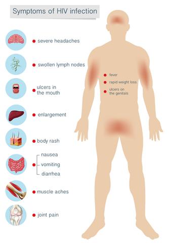 Human Anatomy Symptom på HIV-infektion vektor