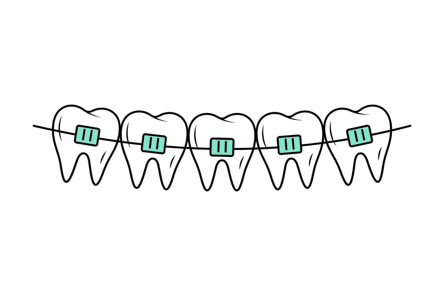 tänder med tandställning i klotter stil. korrigerande ortodonti. dental vård. linjär vektor illustration.