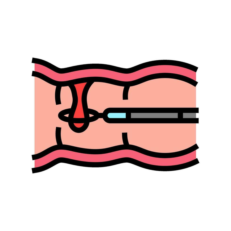 kolon polyper gastroenterolog Färg ikon vektor illustration