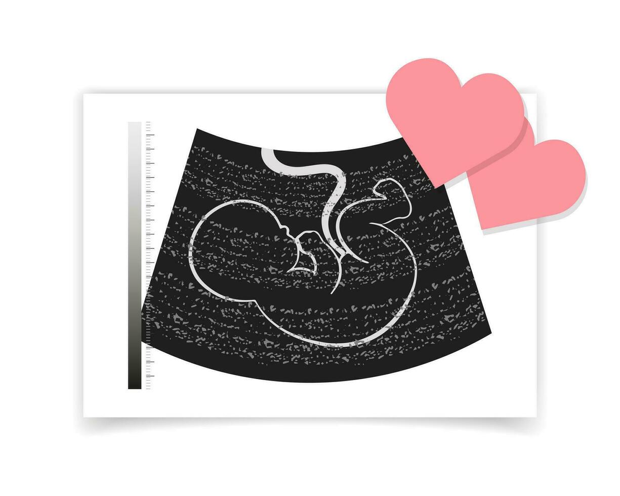 fotografieren von ein Ultraschall von ein ungeboren Baby Embryo und rot Herzen. Illustration, Postkarte, Vektor