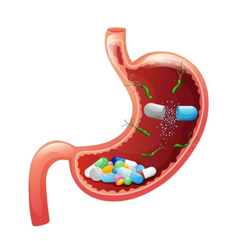 Mensch Bauch mit Droge Kapseln, Tablets, Tabletten und Helicobacter Pylori Innerhalb vektor