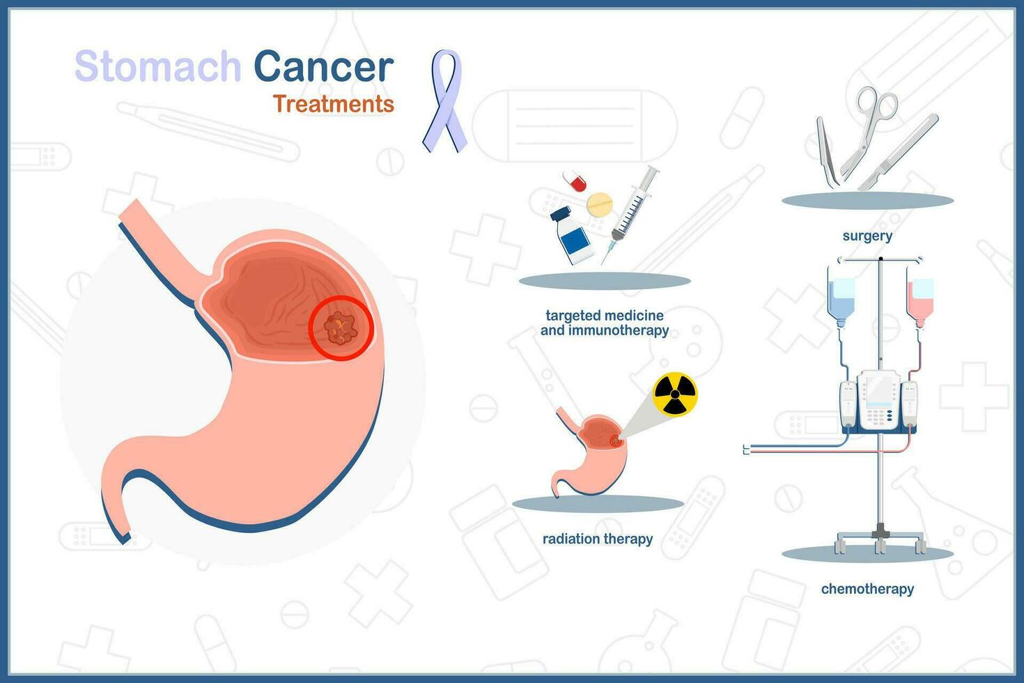 vektor platt medicinsk illustration på mage cancer begrepp. mage cancer behandling.kirurgi, kemoterapi, strålning. terapi, målinriktad terapi och immunterapi.