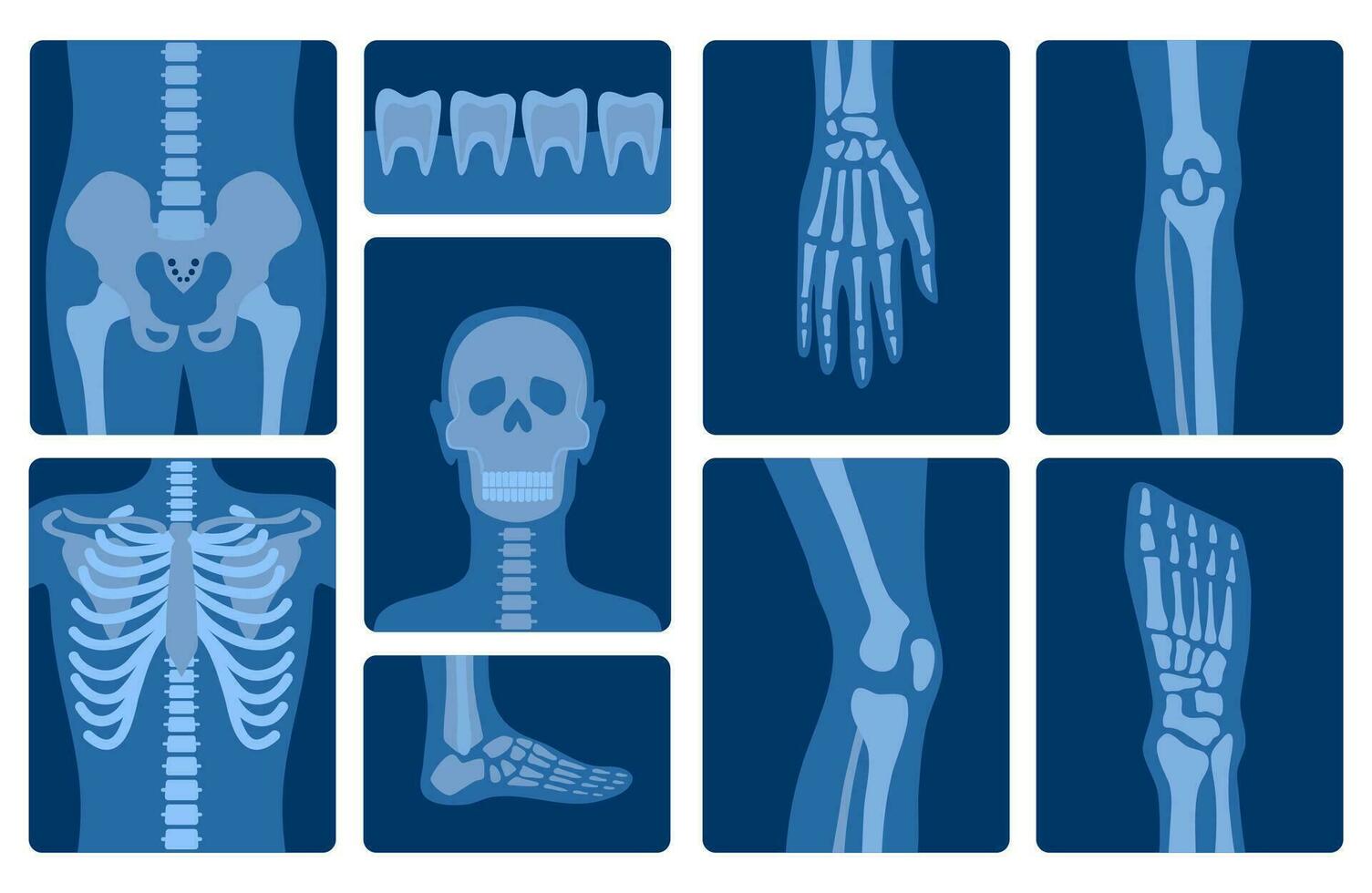 Karikatur Farbe Röntgen Schüsse Mensch Skelett Körper Teile Satz. Vektor