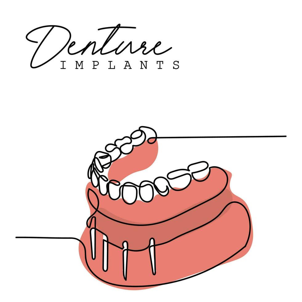 kontinuerlig linje konst av ortodontisk behandling. tandläkare dag och respekt för deras tjänster till mänskligheten vektor