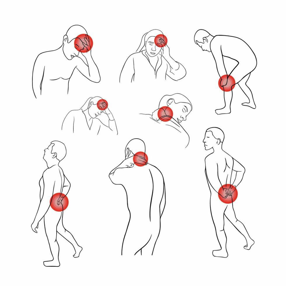 vektor isolerat illustration av tillbaka och gemensam smärta. huvudvärk och nacke smärta. kontur teckning av människor med lokalisering av smärta.