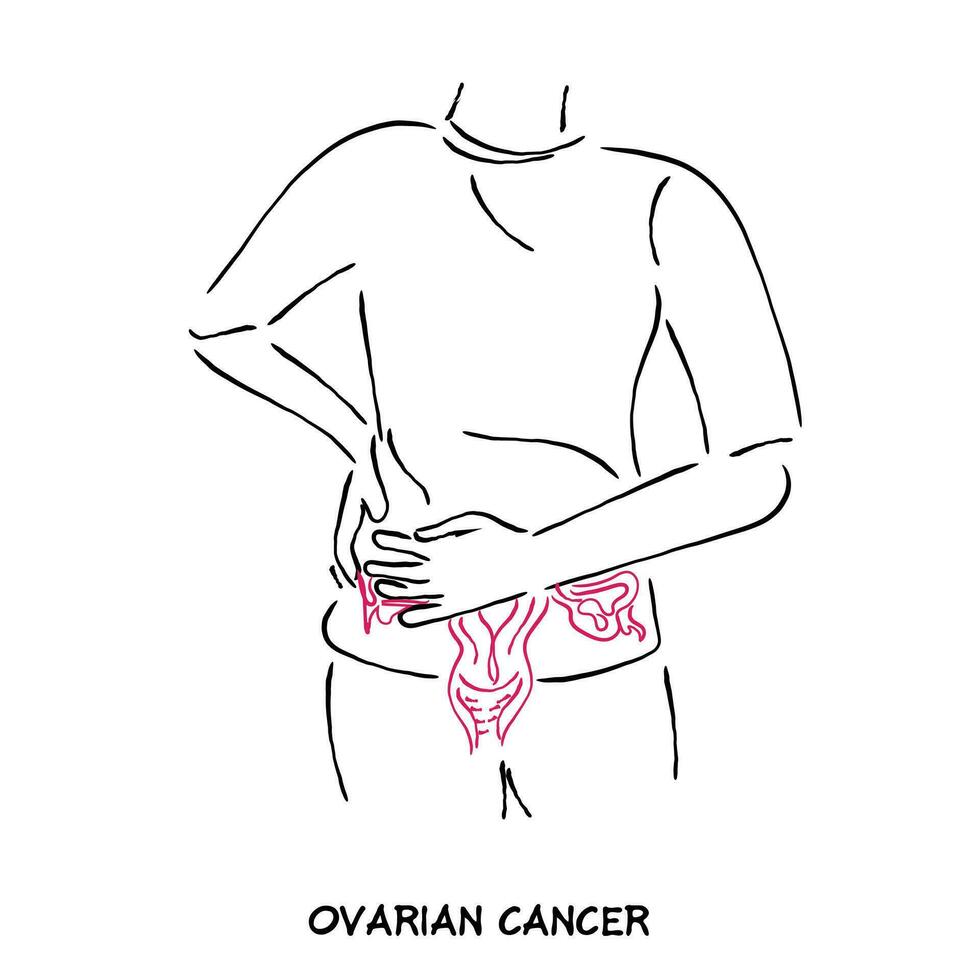 linje konst vektor av äggstockar cancer konstverk. äggstockar cancer ClipArt