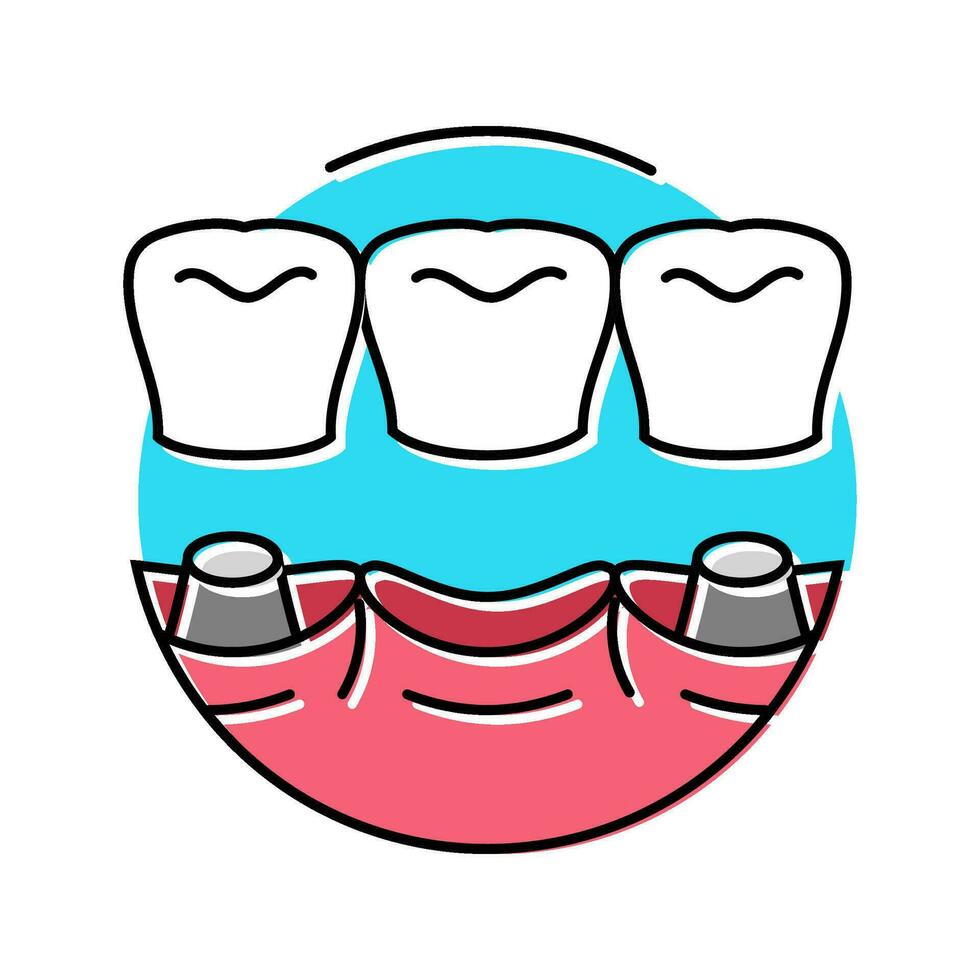 Brücke Dental Verfahren Farbe Symbol Vektor Illustration