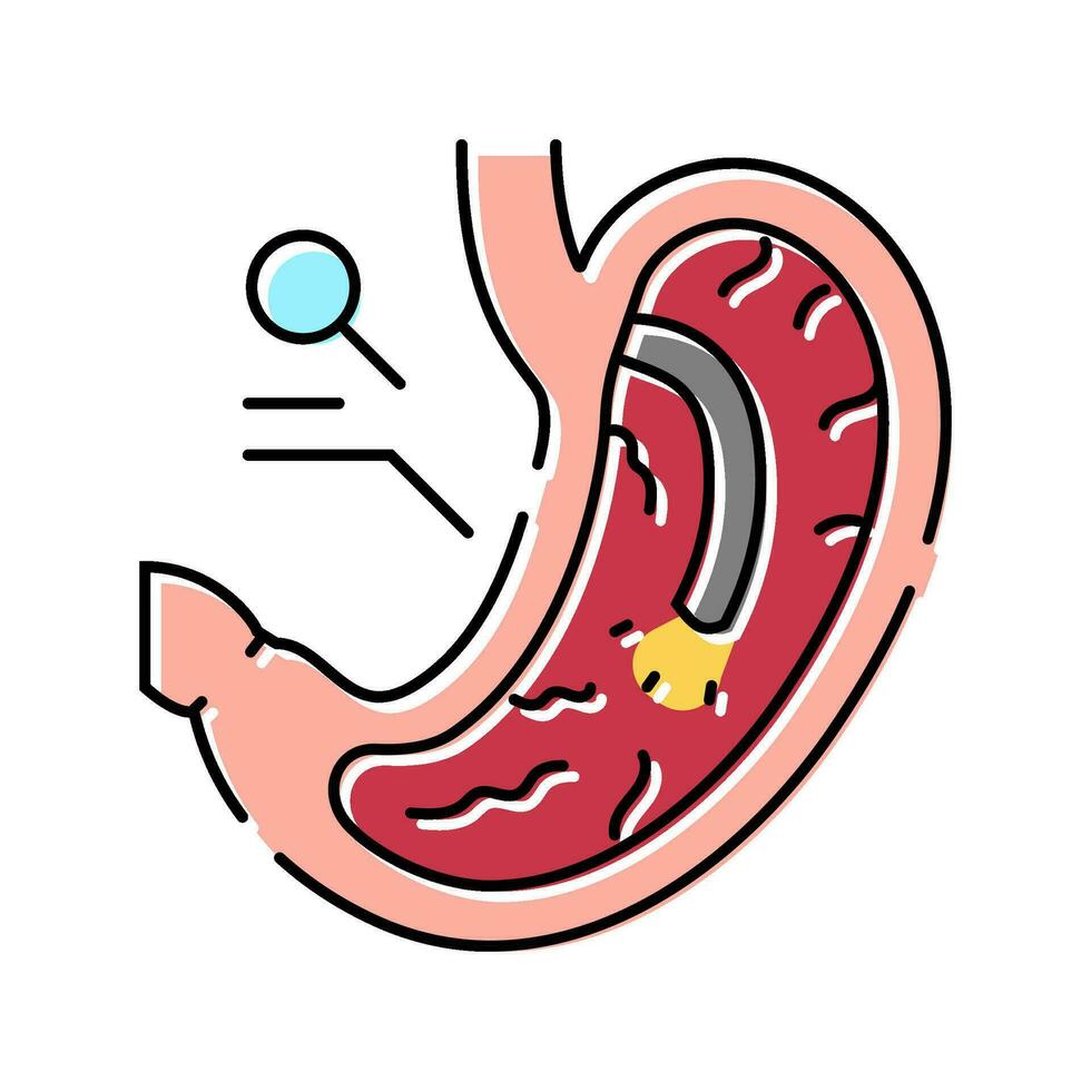 gastroskopi procedur gastroenterolog Färg ikon vektor illustration