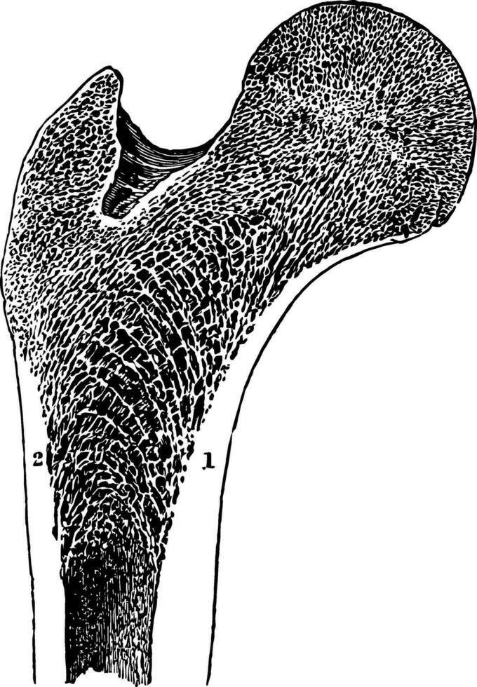 längs Sektion von das Oberschenkelknochen, Jahrgang Illustration. vektor