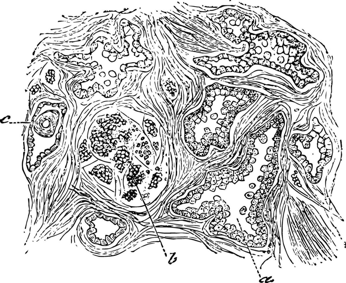 Sektion von das Prostata Drüse, Jahrgang Illustration. vektor