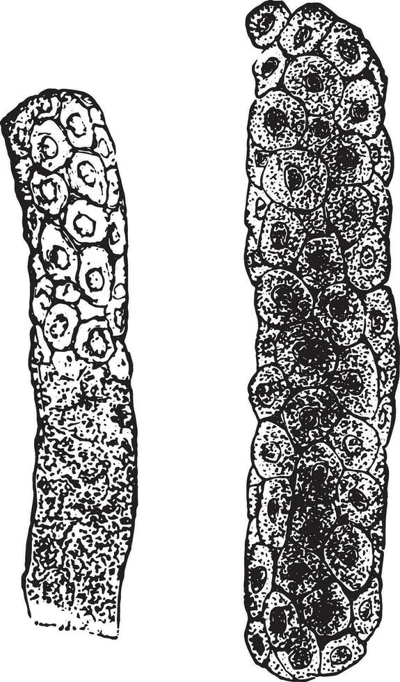 epithelial Abgüsse, Jahrgang Gravur. vektor