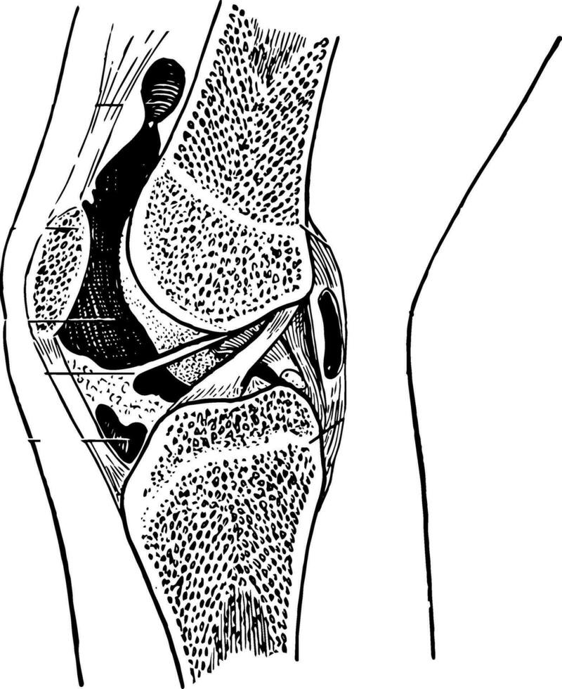 epiphysär Linien im das Knie gemeinsam, Jahrgang Illustration. vektor