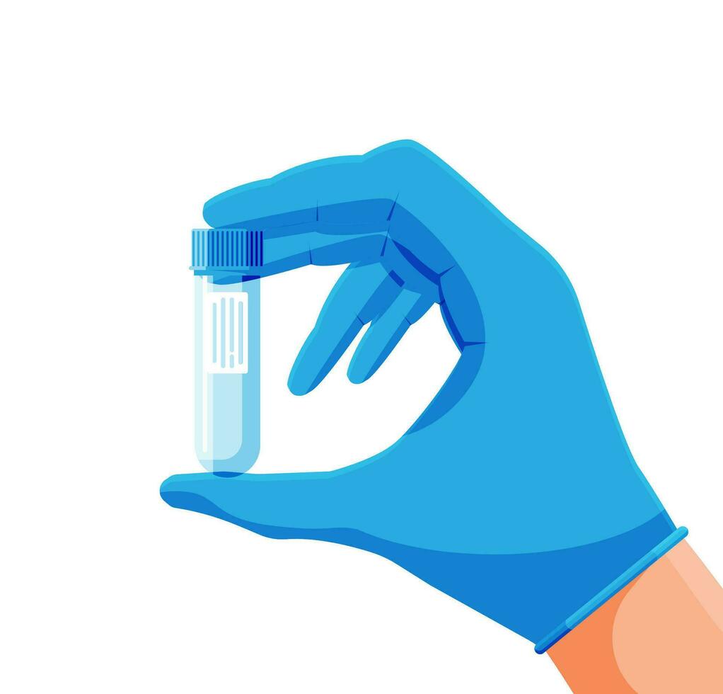 Prüfung Tube mit Deckel im Hand. medizinisch Ausrüstung. Probe Tassen zum gynäkologisch Analyse. leeren Glas Container zum Analyse im medizinisch Labor. Karikatur eben Vektor Illustration