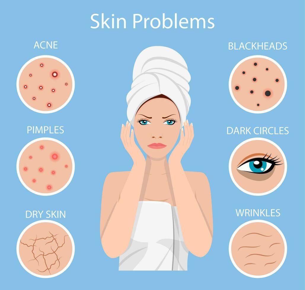 kvinna ansiktsbehandling hud problem behov till vård handla om acne, finnar, rynkor, torr hud, pormaskar, mörk cirklar under ögon vektor