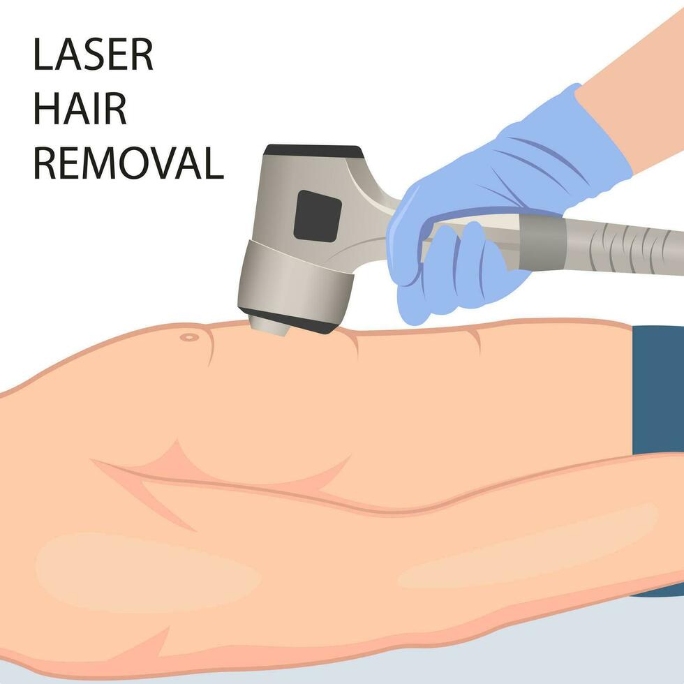 en barbröstad man genomgår en laser hår avlägsnande procedur för en skön och slät kropp vektor