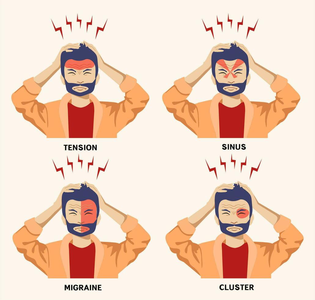 Typen von Kopfschmerzen. Kopfschmerzen auf anders Bereich von geduldig Kopf. eben Vektor Infografiken.
