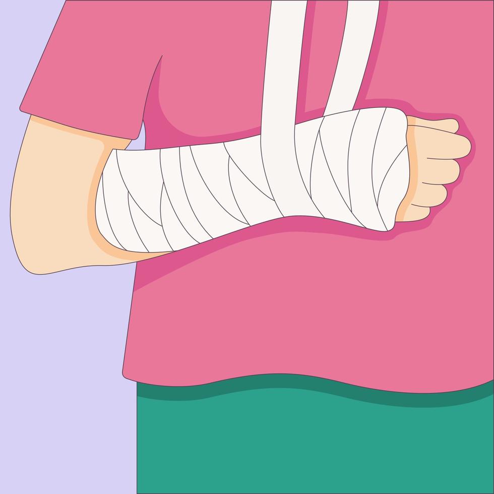 bruten arm i ett gjutet bandage, ortopediskt gips, skada ben, vektor illustration ritad i en platt stil. vektor illustration.