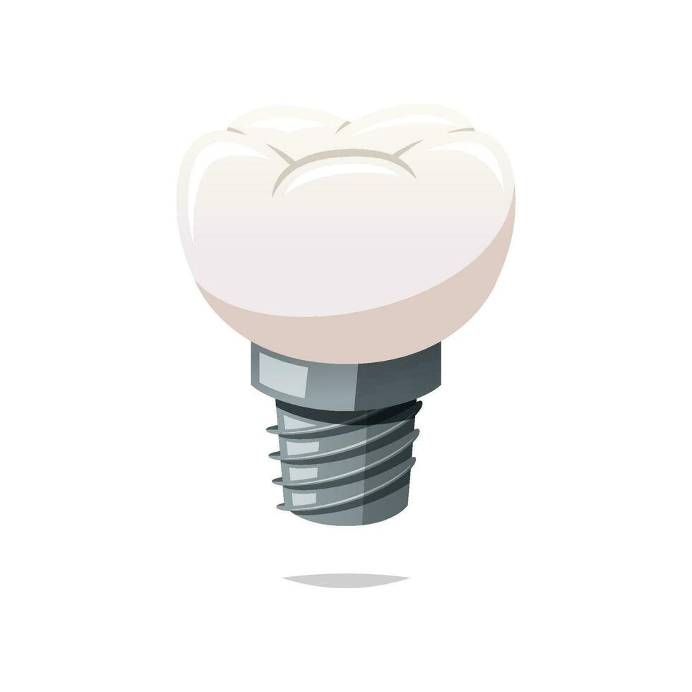 dental implantera vektor isolerat på vit bakgrund