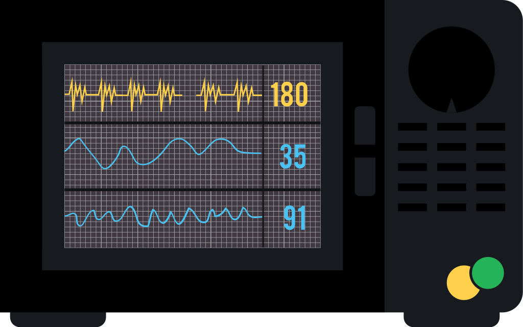 Herz Monitor vektor