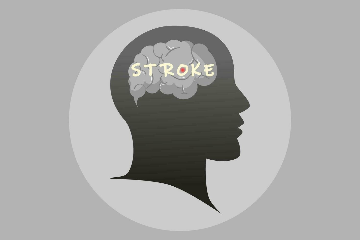 stroke sjukdom begrepp. vektor illustration.