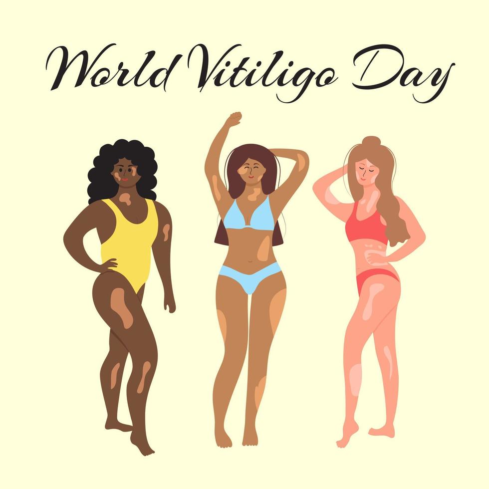 världens vitiligo -dag. le kvinnor i baddräkter av olika nationaliteter och fysiker med vitiligo. vektor