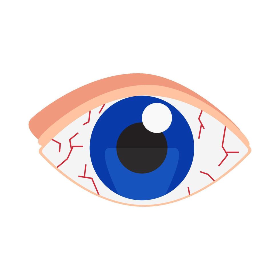 Auge Allergie Illustration vektor