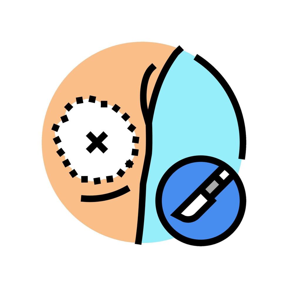 Mastektomie Chirurgie Krankenhaus Farbe Symbol Vektor Illustration