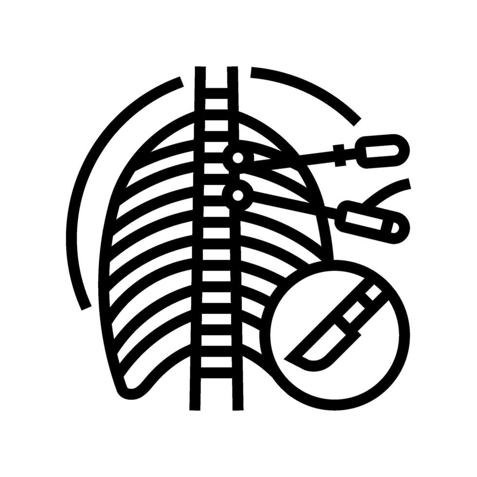 Sympathektomie Chirurgie Krankenhaus Linie Symbol Vektor Illustration