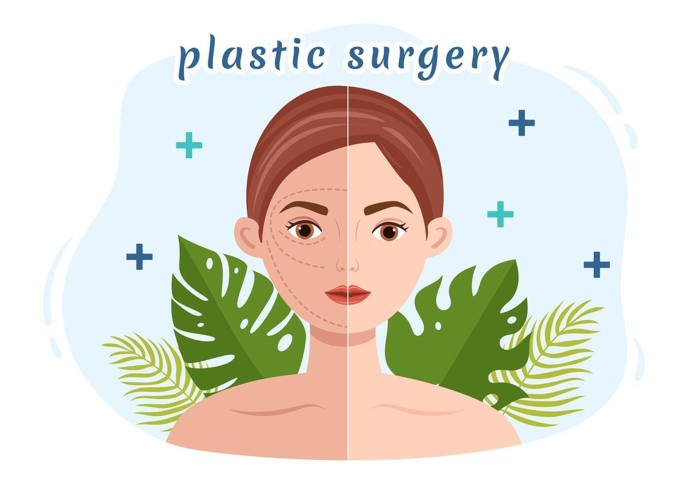 plast kirurgi vektor illustration av medicinsk kirurgisk drift på de kropp eller ansikte som förväntas använder sig av Avancerad Utrustning i tecknad serie bakgrund