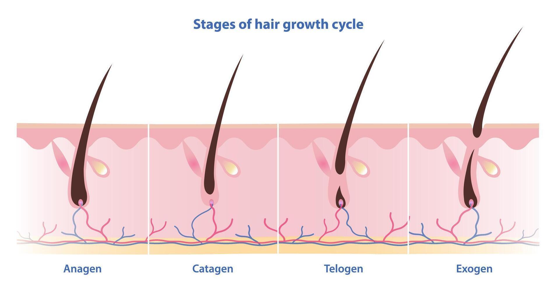 stadier av hår tillväxt cykel vektor isolerat på vit bakgrund. hår växer i fyra distinkt etapper. anagen, växande fas. catagen, övergång fas. telogen, vilar fas. exogen, shedding fas.