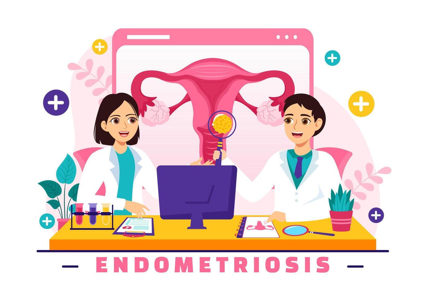 Endometriose Vektor Illustration mit Bedingung das Endometrium wächst draußen das Gebärmutter- Mauer im Frauen zum Behandlung im eben Karikatur Hintergrund