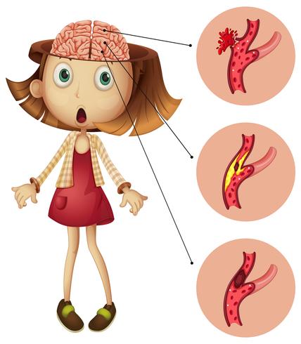 Flicka med hjärtslagsdiagram vektor