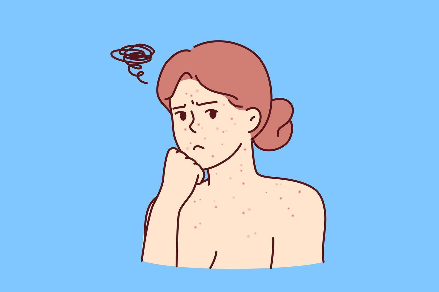 Frau mit allergisch Ausschlag auf Gesicht und Körper sieht aus traurig beim Bildschirm, brauchen Hilfe von Dermatologe vektor