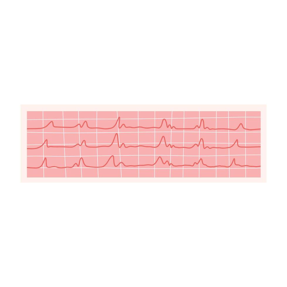 ecg illustration. elektrokardiogram isolerat på en vit bakgrund. vektor