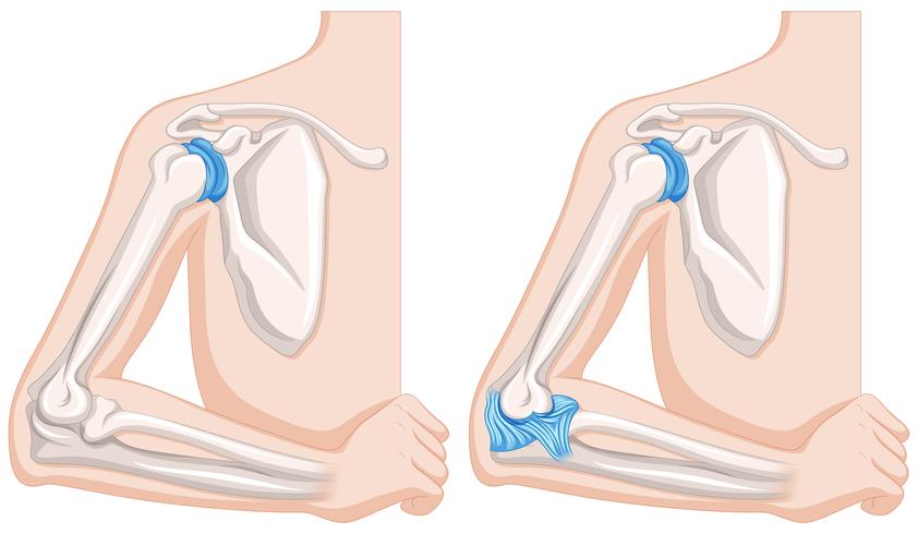 Närbildsdiagram över mänskliga armbågsskarvar vektor