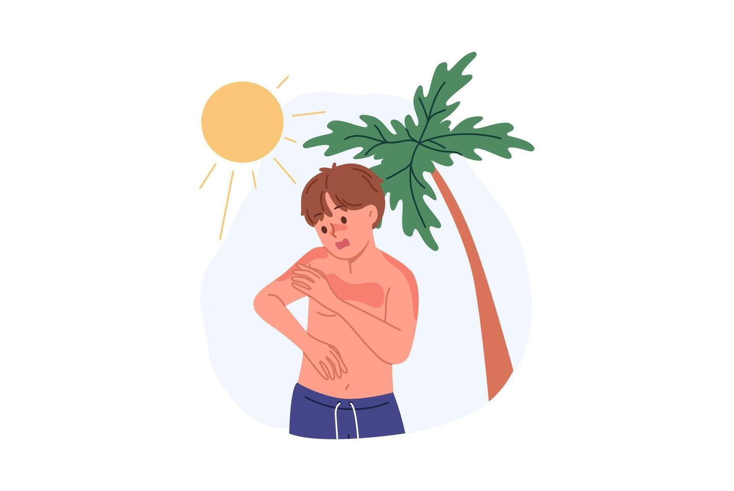Junge empfangen Sonnenbrand fällig zu ultraviolett Allergie oder Heliophobie, Stehen auf Strand mit Palme Baum vektor