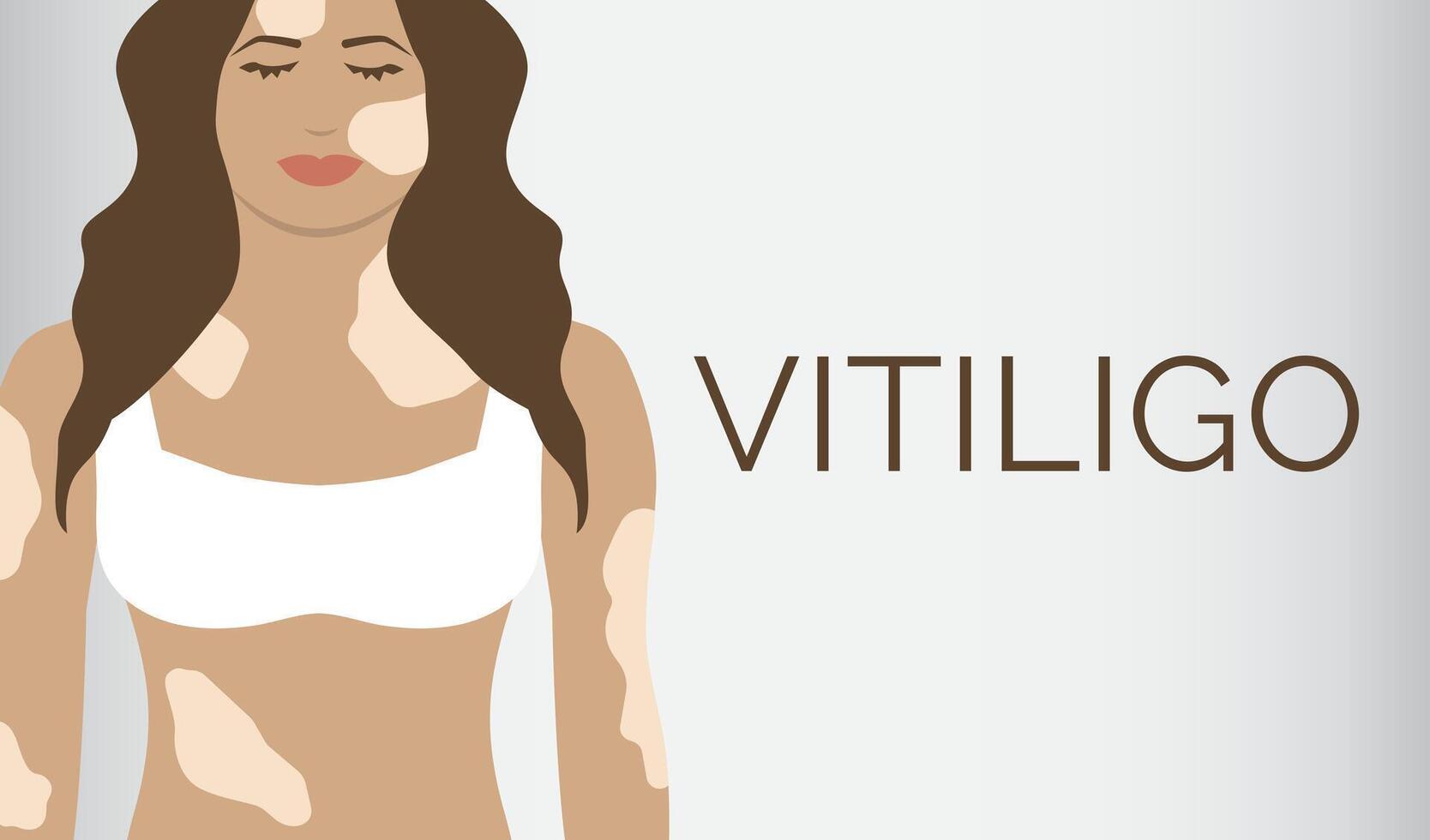 Vitiligo Haut Krankheit Banner Hintergrund vektor