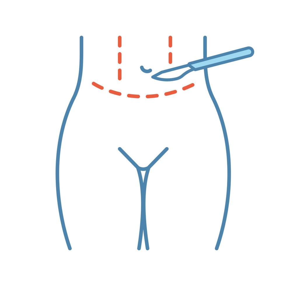 Bauchdeckenstraffung Kunststoff-Farbsymbol. Bauchdeckenstraffung. Fettabsaugung am Magen. Bauch heben. plastische Chirurgie. isolierte Vektorillustration vektor