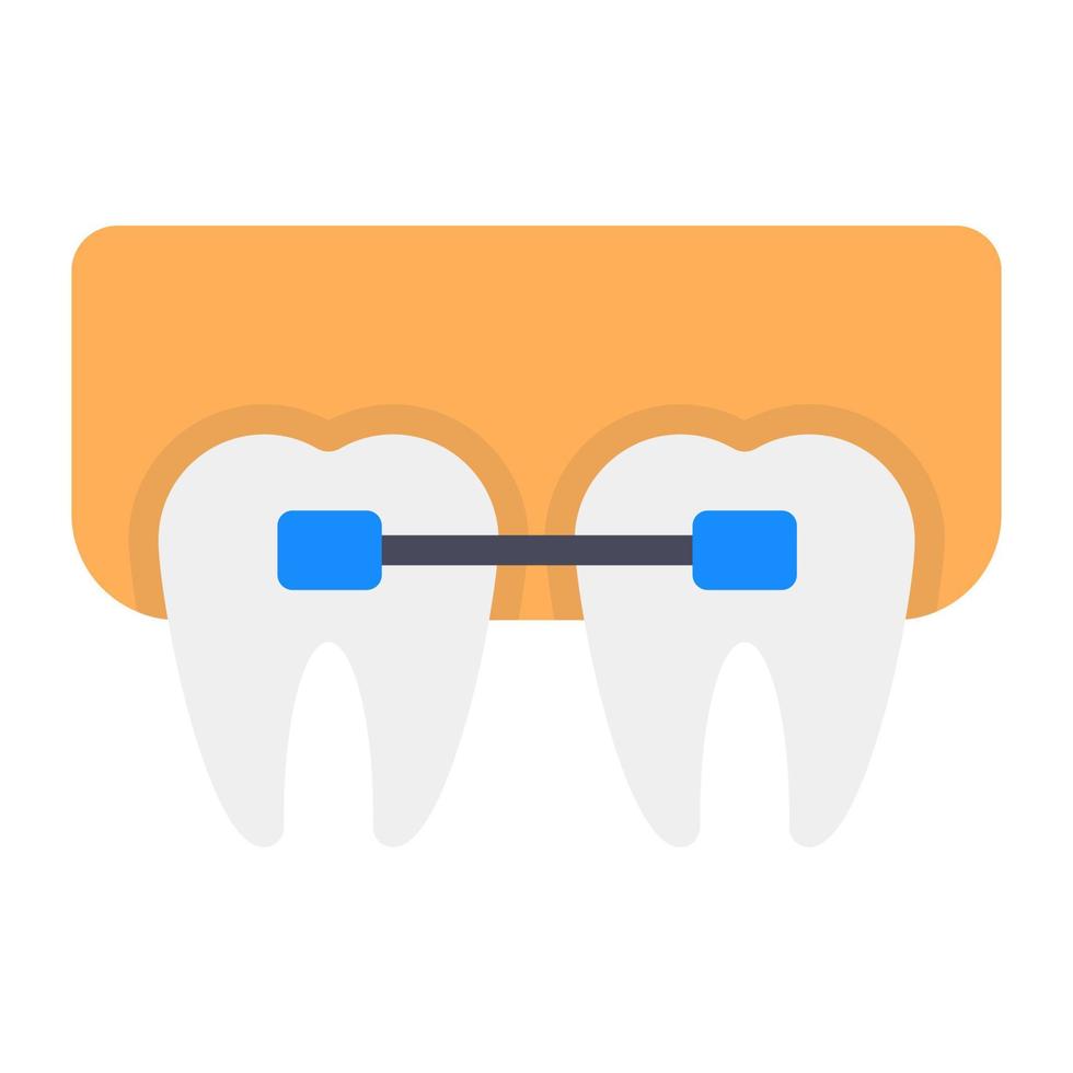 Zahnspangen zum Ausrichten und Begradigen der Zähne vektor