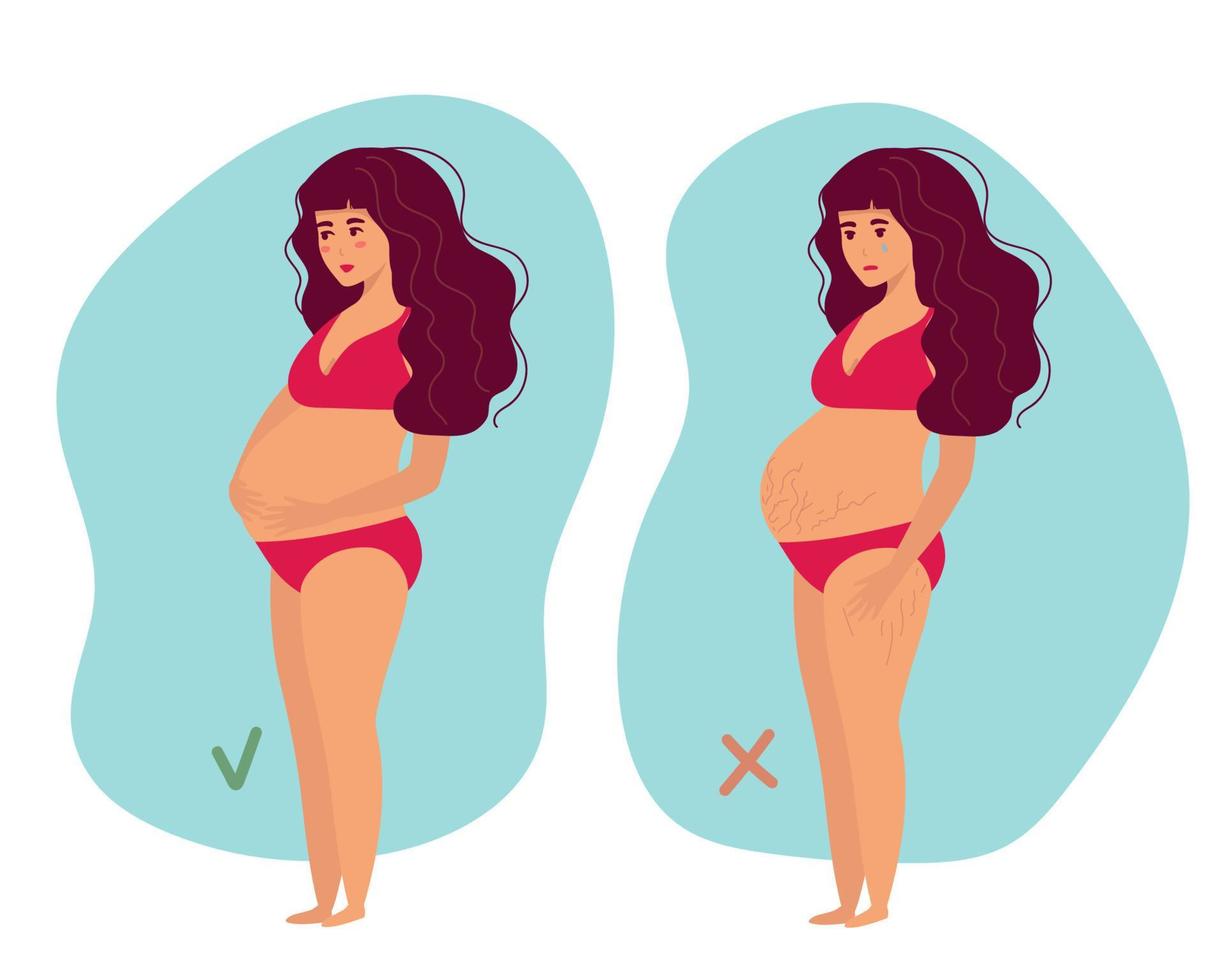 graviditetsmage, bristningar. självkärlek, kroppspositivt moderskap. förberedelse inför förlossningen. vektor illustration. för reklam, medicinska publikationer, för läkemedel, krämer