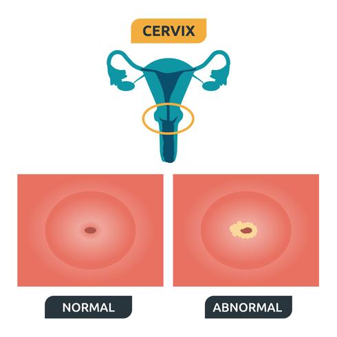 cervix vektor