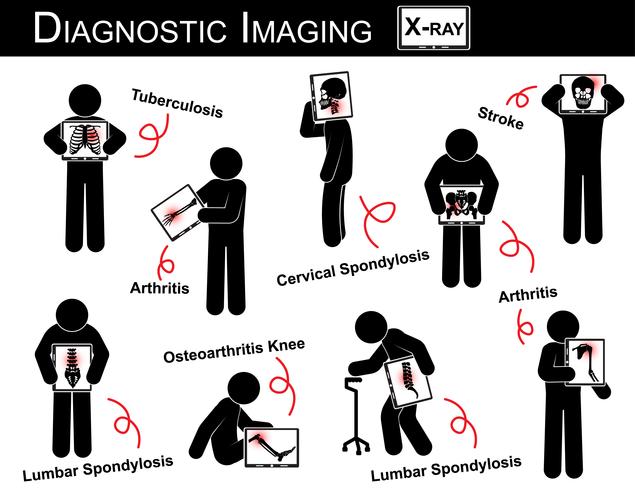 Diagnostisk Imaging &amp; Multiple Disease Stick Man Vector (Lung Tuberkulos, Arthritis, Cervical Spondylosis, Lumbar Spondylosis &amp; Spondylolisthesis, Scoliosis, Osteoarthritis Knä, Slag)