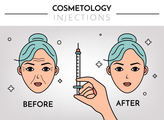 Kosmetische Injektionen. Infografiken vor und nach. Flache Illustration des Vektors mit Platz für Text. Mesotherapie, Verjüngung. vektor