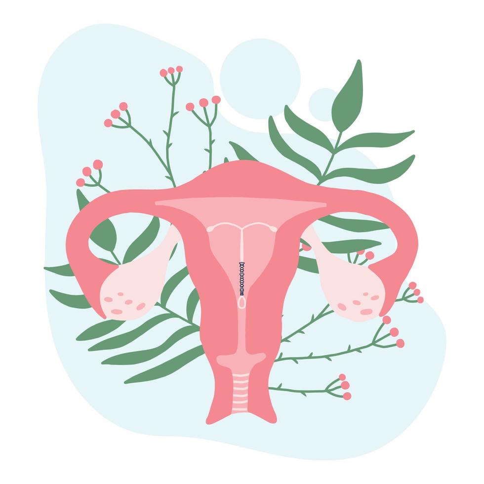 kvinnlig livmoder med spiral. kvinnligt preventivmedel. spiral som preventivmetod. affisch med mamma och löv. världen preventivmedel day.vector illustration i platt stil. vektor