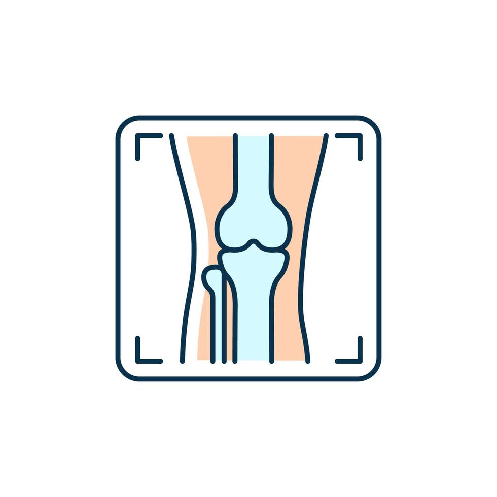 artrit x ray rgb färgikon. leddeformitetsskildring. artros diagnos. medicinsk bildbehandling. röntgenbevis på beninflammation. isolerade vektor illustration. enkel fylld linjeritning