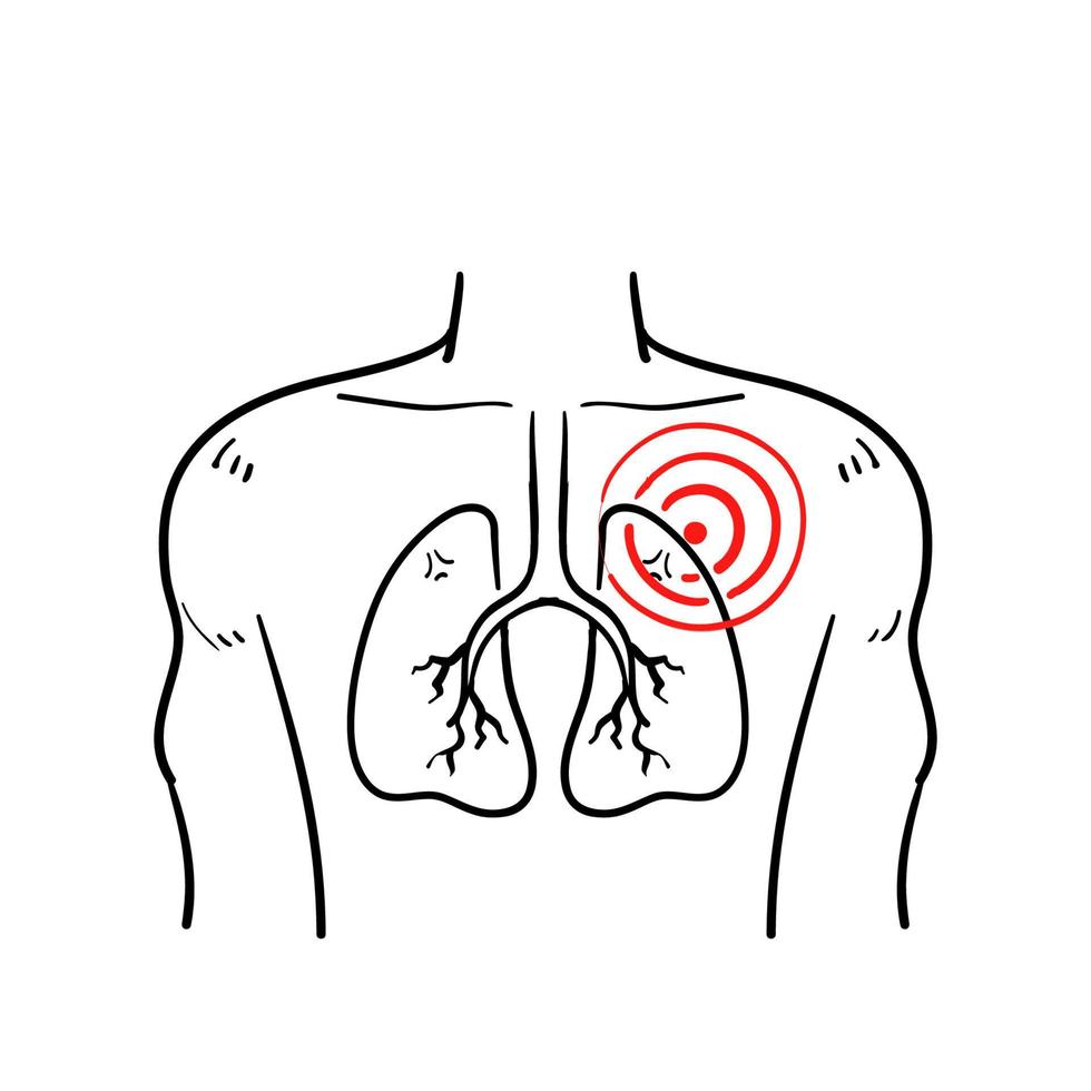 handgezeichnetes Lungenentzündungssymbol, Asthma oder Tuberkulose, Liniensymbol auf weißem Hintergrund. im Gekritzelartvektor lokalisiert vektor